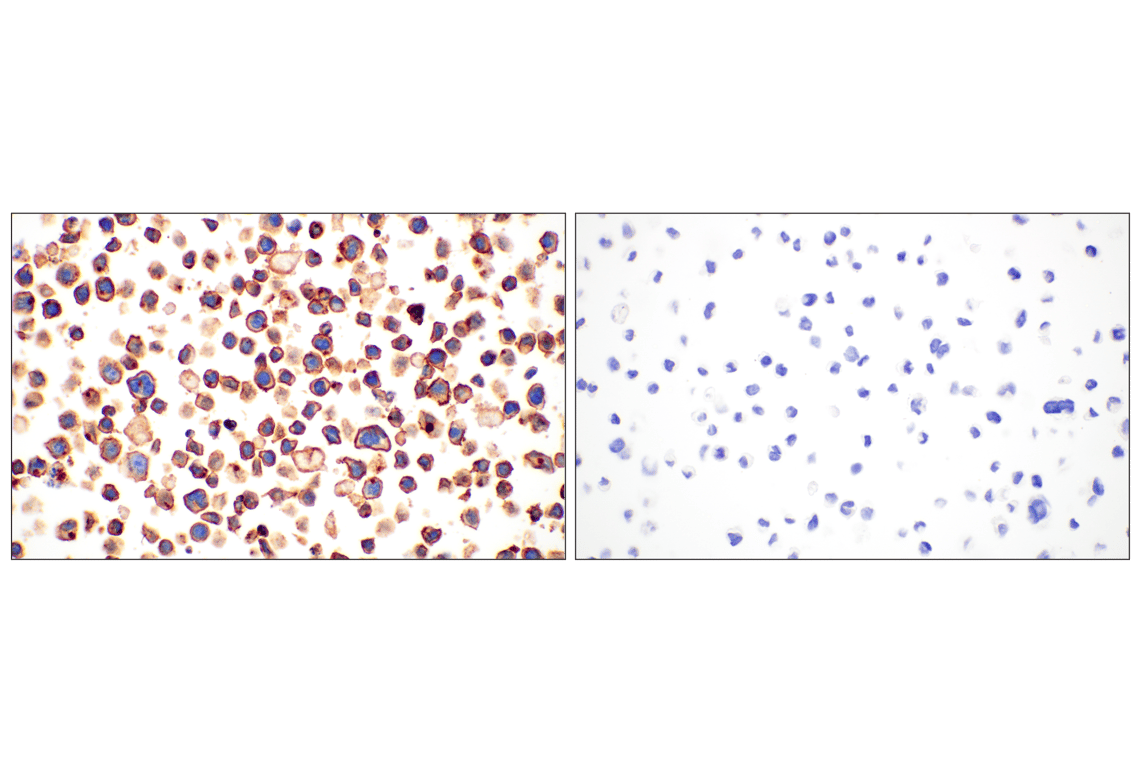 Immunohistochemistry Image 8: CD28 (D2Z4E) Rabbit Monoclonal Antibody