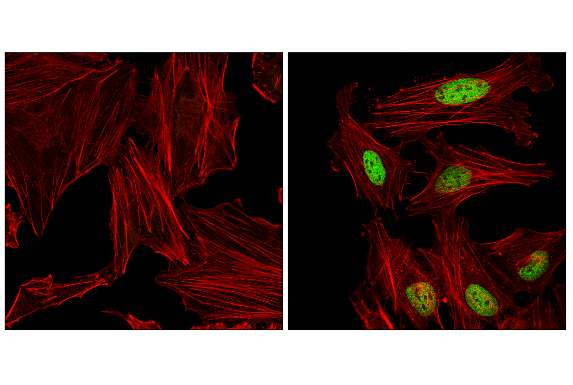 Immunofluorescence Image 1: ATF-4 (E4Q4E) Mouse Monoclonal Antibody (BSA and Azide Free)