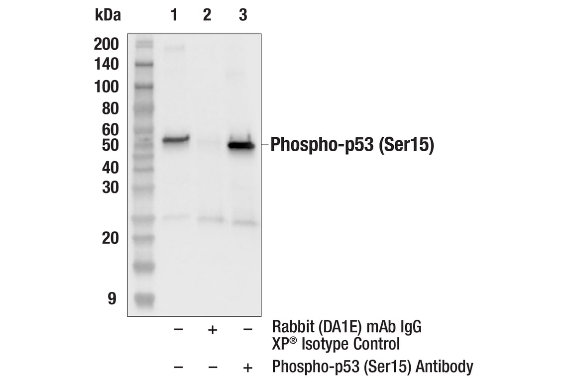 Immunoprecipitation Image 1: Phospho-p53 (Ser15) Antibody