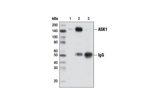 Immunoprecipitation Image 1: ASK1 (D11C9) Rabbit Monoclonal Antibody