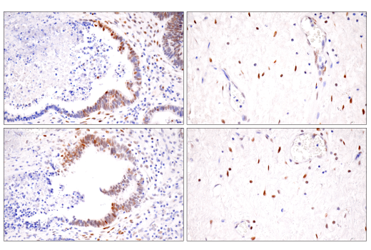 Immunohistochemistry Image 7: HIF-1 alpha (E1V6A) Rabbit Monoclonal Antibody (BSA and Azide Free)