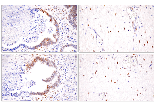 Immunohistochemistry Image 7: HIF-1α (E1V6A) Rabbit mAb (BSA and Azide Free)