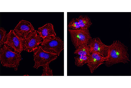 Immunofluorescence Image 1: βIG-H3 (D31B8) XP<sup>®</sup> Rabbit mAb