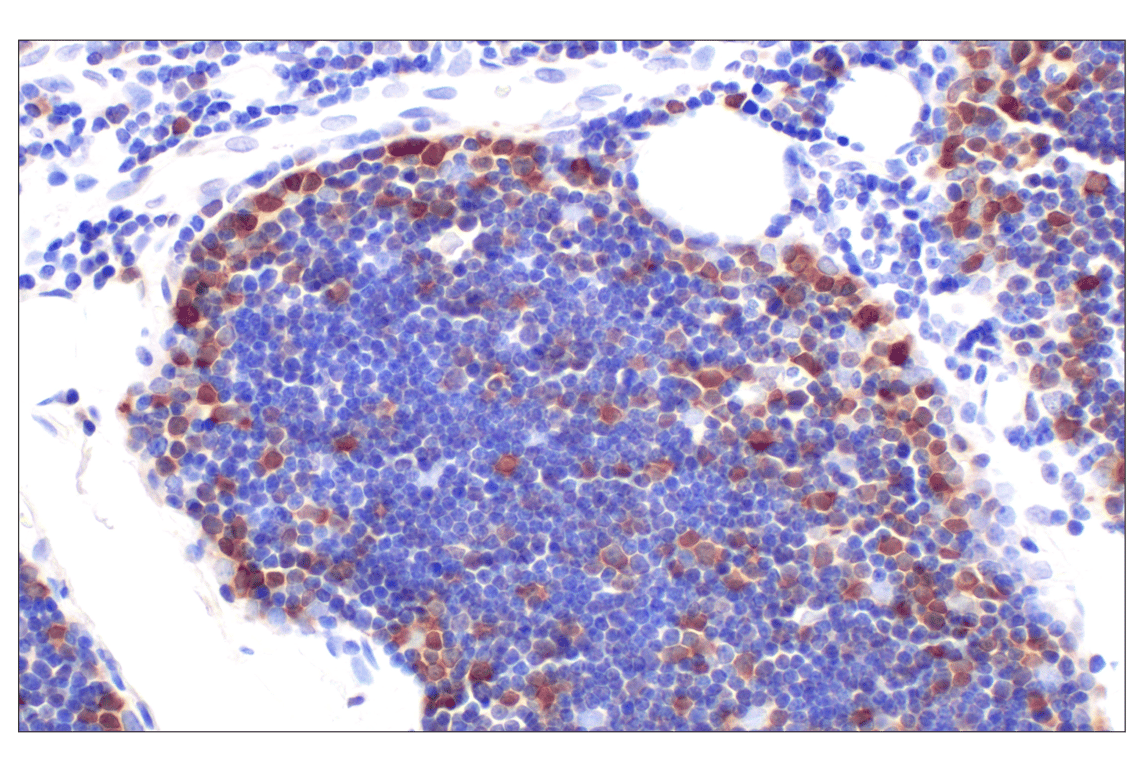 Immunohistochemistry Image 4: CDK6 (E3E3Q) Rabbit Monoclonal Antibody (BSA and Azide Free)