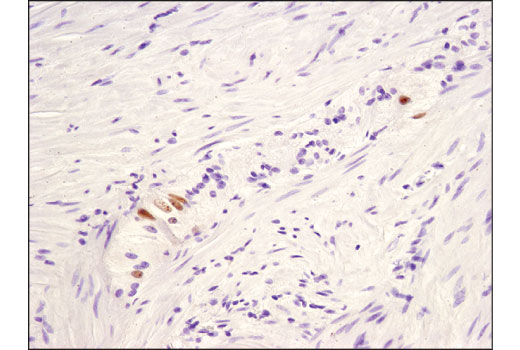 Immunohistochemistry Image 2: CHD5 (D2F9Q) Rabbit Monoclonal Antibody