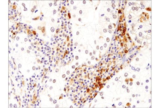 Immunohistochemistry Image 1: TFEB (D2O7D) Rabbit Monoclonal Antibody (BSA and Azide Free)