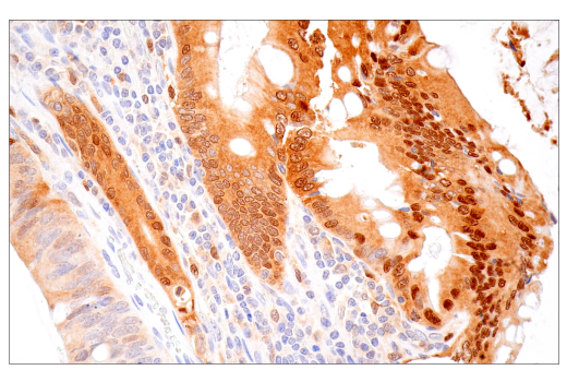 Immunohistochemistry Image 2: IL-18 (E3G8R) Rabbit Monoclonal Antibody (BSA and Azide Free)