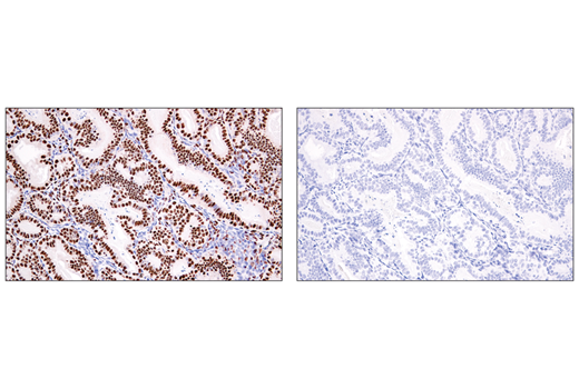 Immunohistochemistry Image 3: ADAR1 (E6X9R) Rabbit Monoclonal Antibody