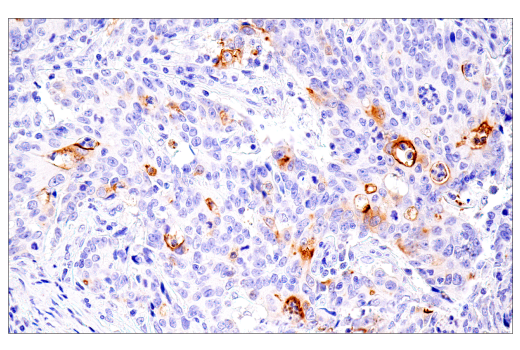 Immunohistochemistry Image 4: ACE2 (E5O6J) Rabbit Monoclonal Antibody (BSA and Azide Free)