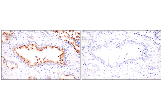 Immunohistochemistry Image 10: Furin (E2Y2F) Rabbit Monoclonal Antibody