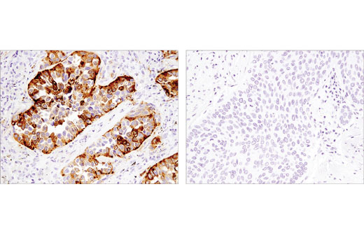 Immunohistochemistry Image 1: Napsin A (D5P6G) Rabbit Monoclonal Antibody