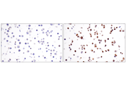 Immunohistochemistry Image 9: HIF-1 alpha (E1V6A) Rabbit Monoclonal Antibody (BSA and Azide Free)