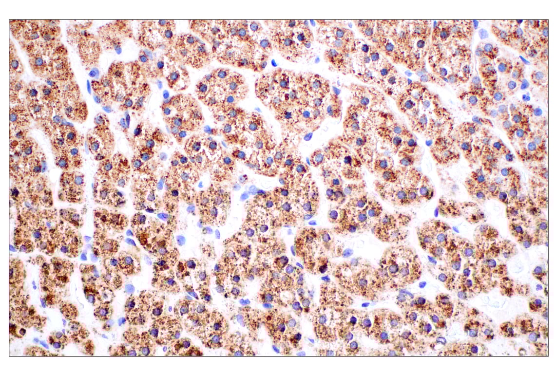 undefined Image 29: Genetics of Parkinson's Disease: Lysosomal Dysfunction Antibody Sampler Kit
