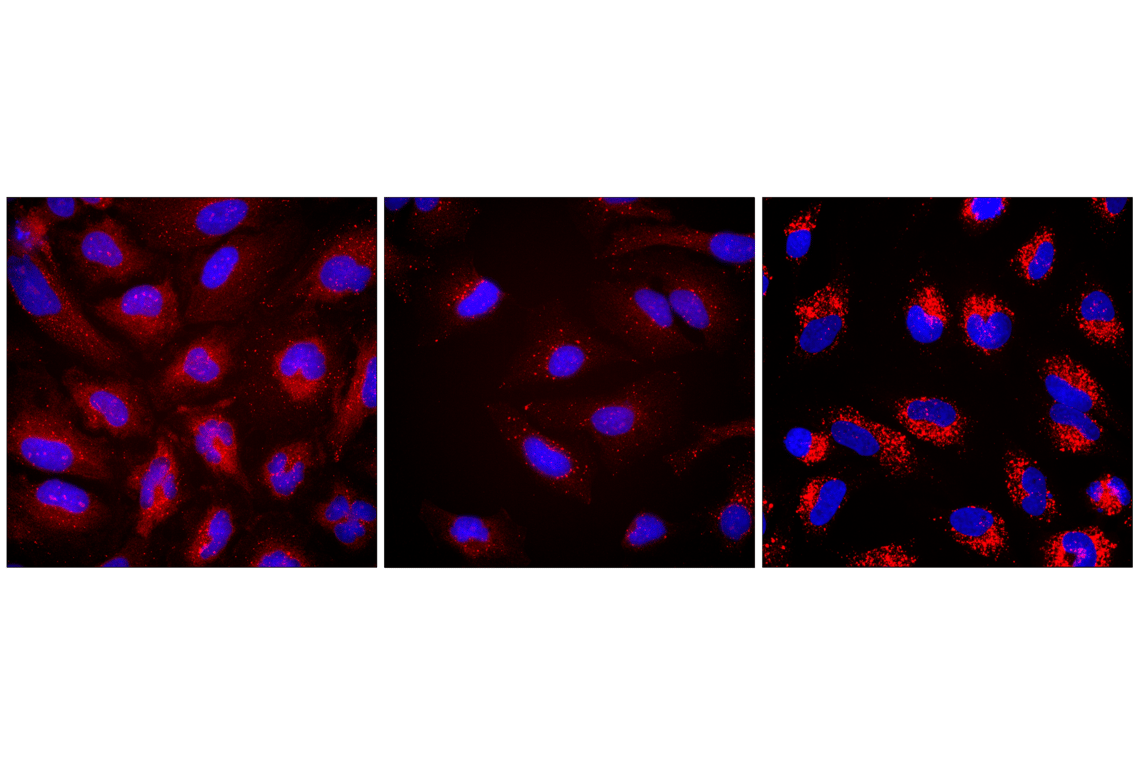 Immunofluorescence Image 1: LC3A/B (D3U4C) XP<sup>®</sup> Rabbit mAb (iFluor<sup>®</sup> 594 Conjugate)