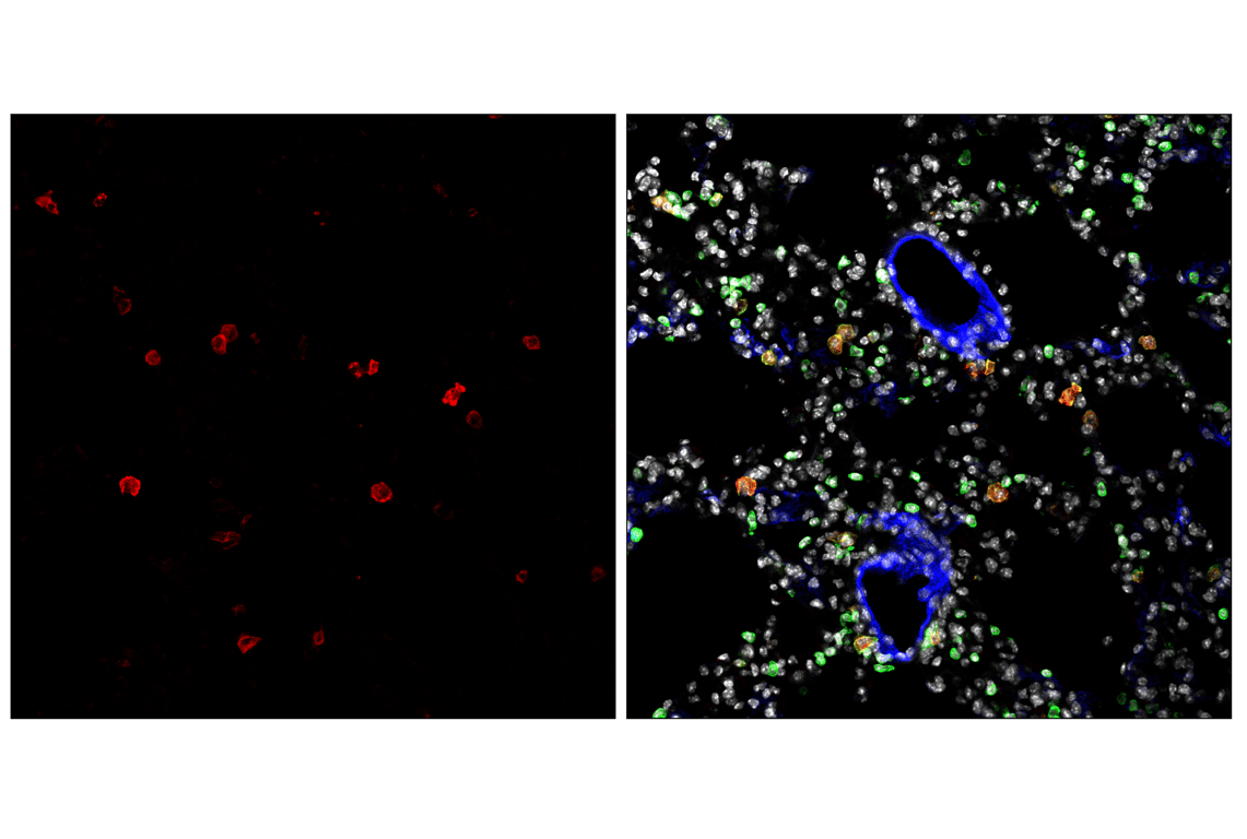 Immunofluorescence Image 1: CD11c (D1V9Y) Rabbit Monoclonal Antibody (Alexa Fluor<sup>®</sup> 647 Conjugate)