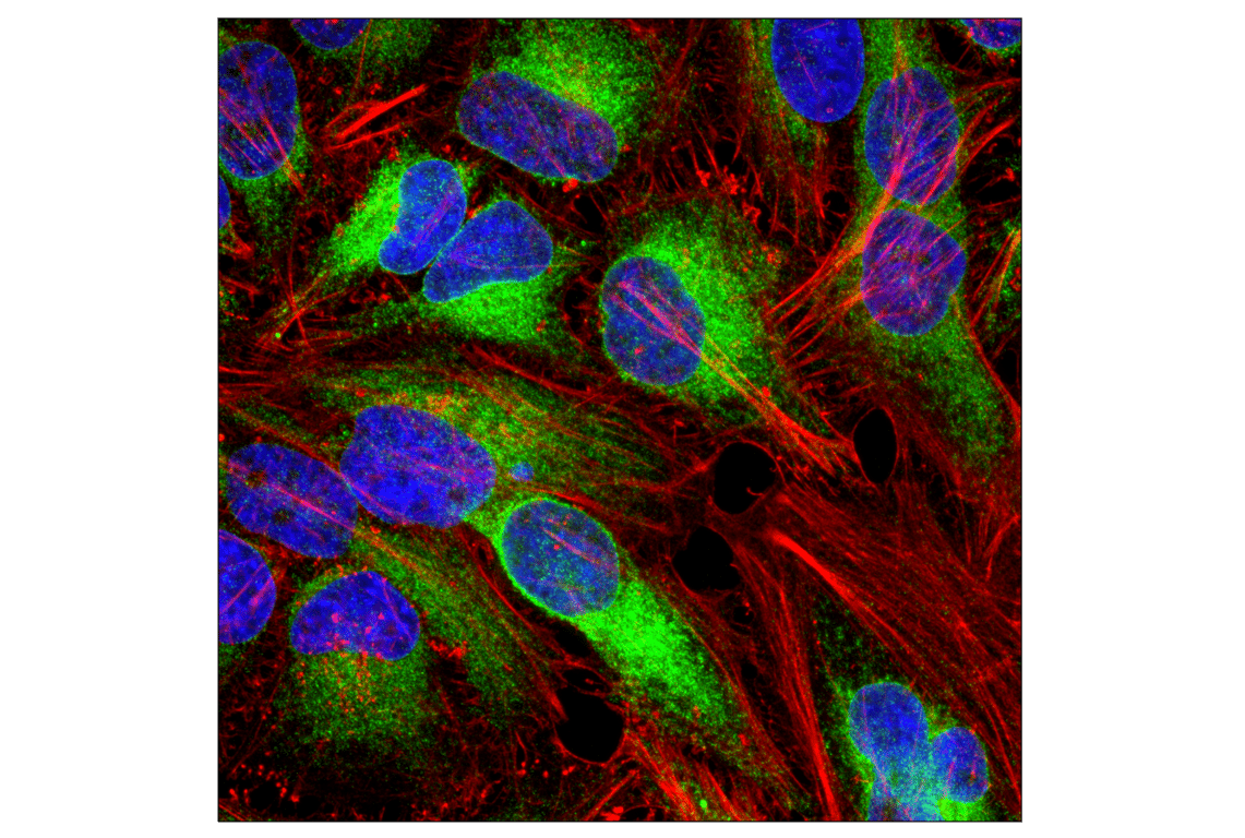 undefined Image 25: ER Stress Antibody Sampler Kit