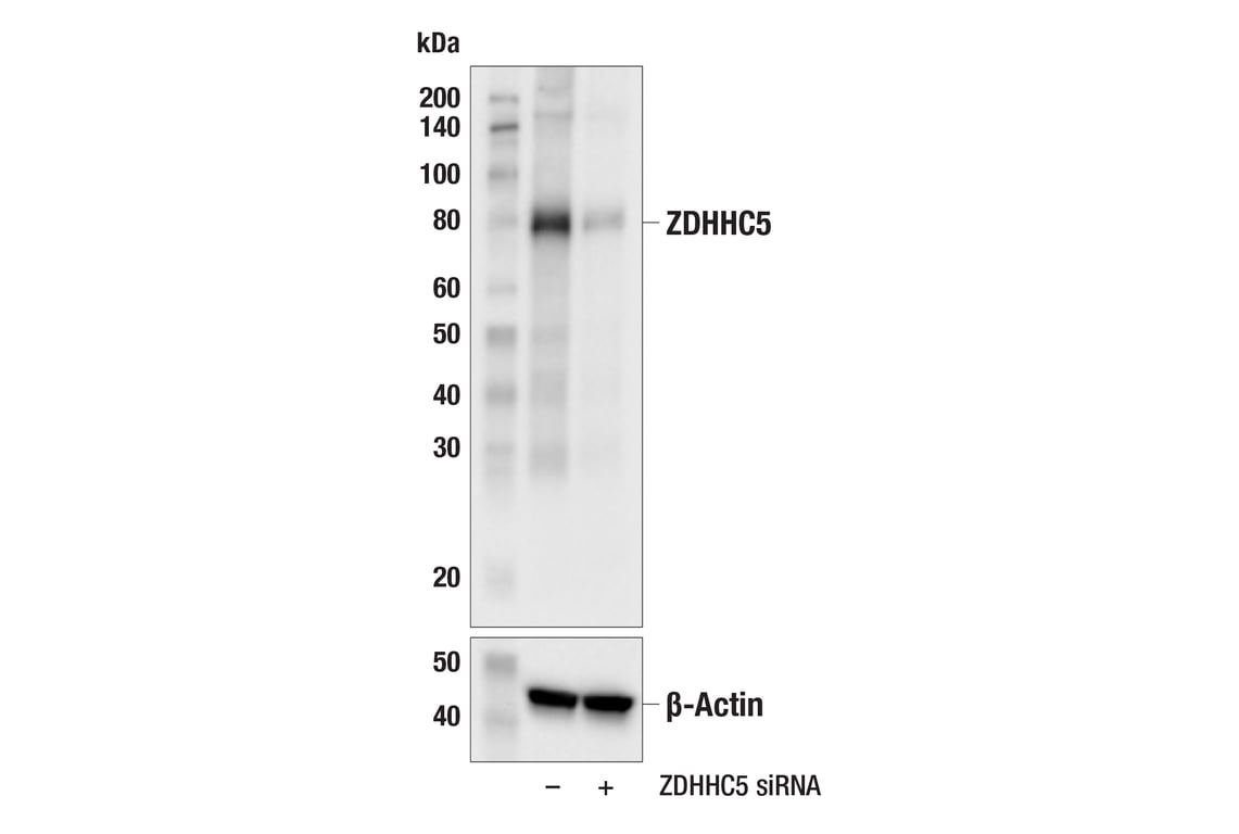 Western Blotting Image 2: ZDHHC5 (E7T4N) Rabbit Monoclonal Antibody