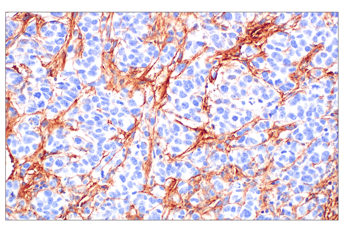 Fibronectin/FN1 (F7X7I) Rabbit Monoclonal Antibody | Cell