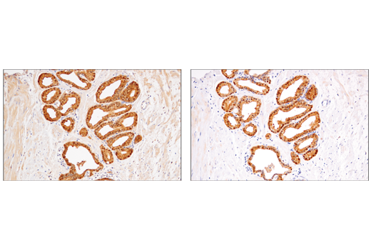 Immunohistochemistry Image 3: IDH1 (RcMab-1) Rat Monoclonal Antibody
