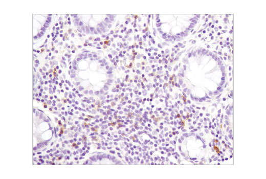 Immunohistochemistry Image 1: GITR (D9I9D) Rabbit Monoclonal Antibody (BSA and Azide Free)