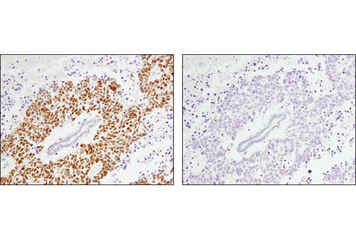 undefined Image 35: BAF Complex Antibody Sampler Kit