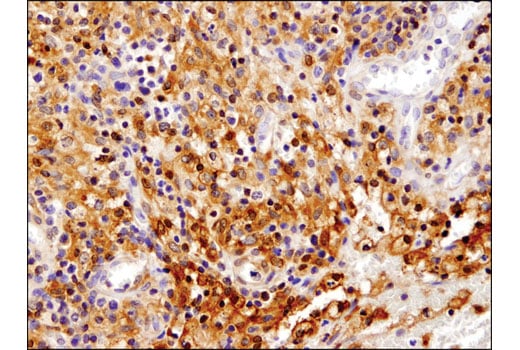 undefined Image 24: Stat Antibody Sampler Kit II