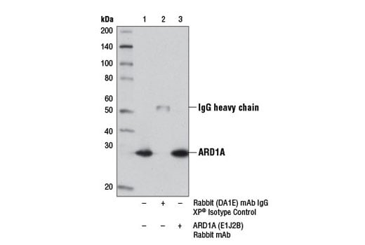 Immunoprecipitation Image 1: ARD1A (E1J2B) Rabbit Monoclonal Antibody