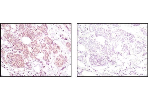 Immunohistochemistry Image 1: Akt (pan) (40D4) Mouse Monoclonal Antibody