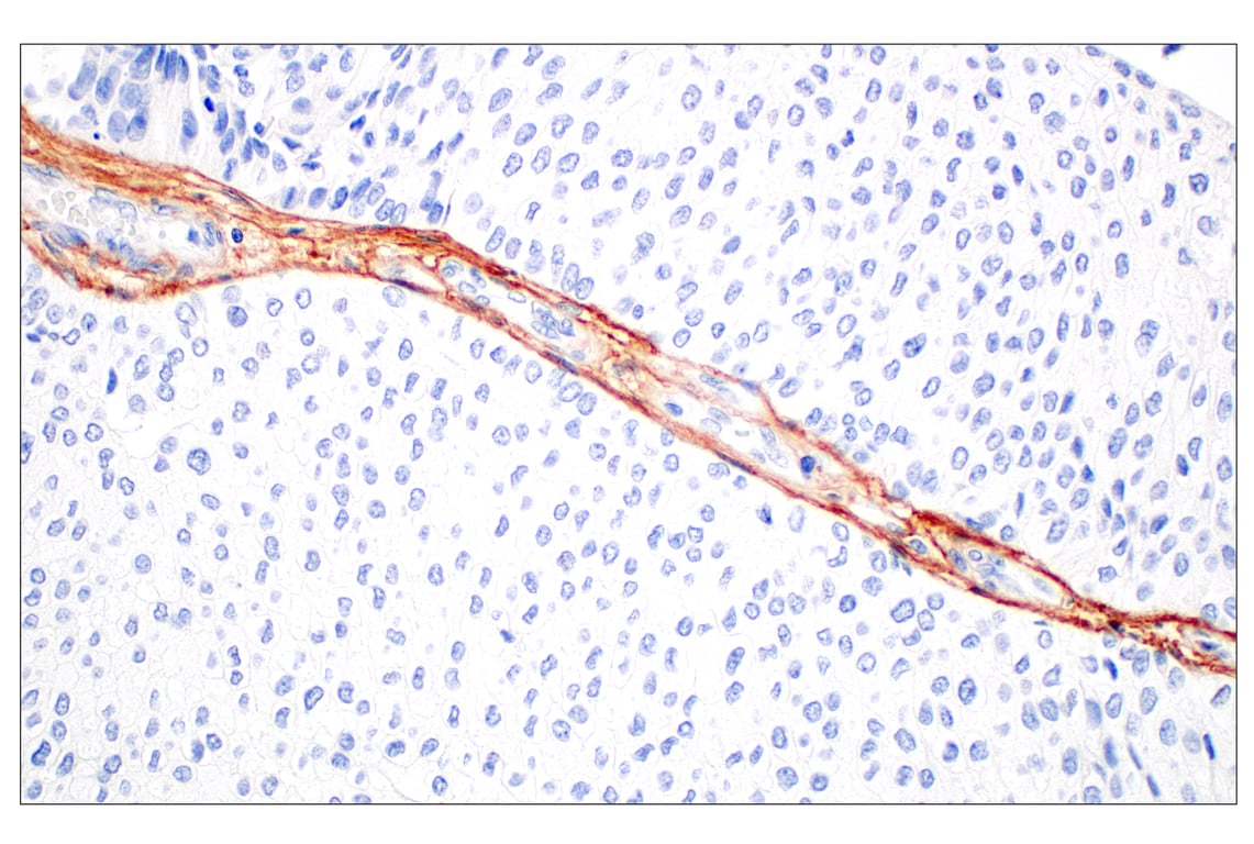 Immunohistochemistry Image 3: Tenascin C (E6N4L) Rabbit mAb