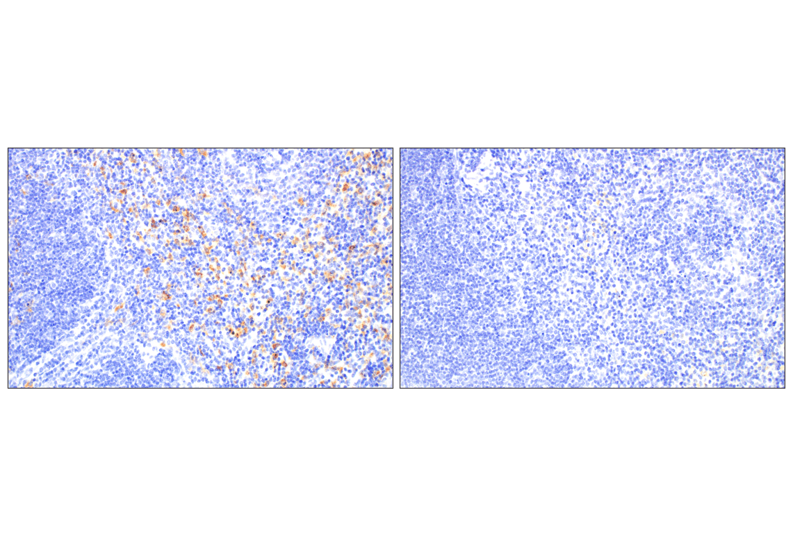 Immunohistochemistry Image 6: C1QB (E3U6X) Rabbit Monoclonal Antibody (BSA and Azide Free)