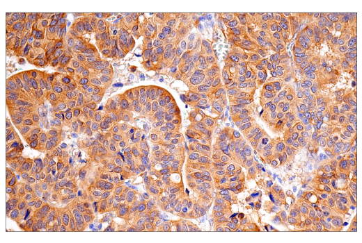 Immunohistochemistry Image 2: CRP2 (E8R5N) Rabbit Monoclonal Antibody