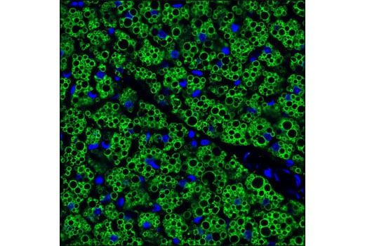 Immunofluorescence Image 1: Perilipin-1 (D1D8) Rabbit Monoclonal Antibody