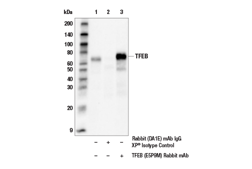 Immunoprecipitation Image 2: TFEB (E5P9M) Rabbit Monoclonal Antibody
