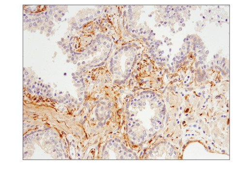 Immunohistochemistry Image 5: RhoB (D1J9V) Rabbit Monoclonal Antibody