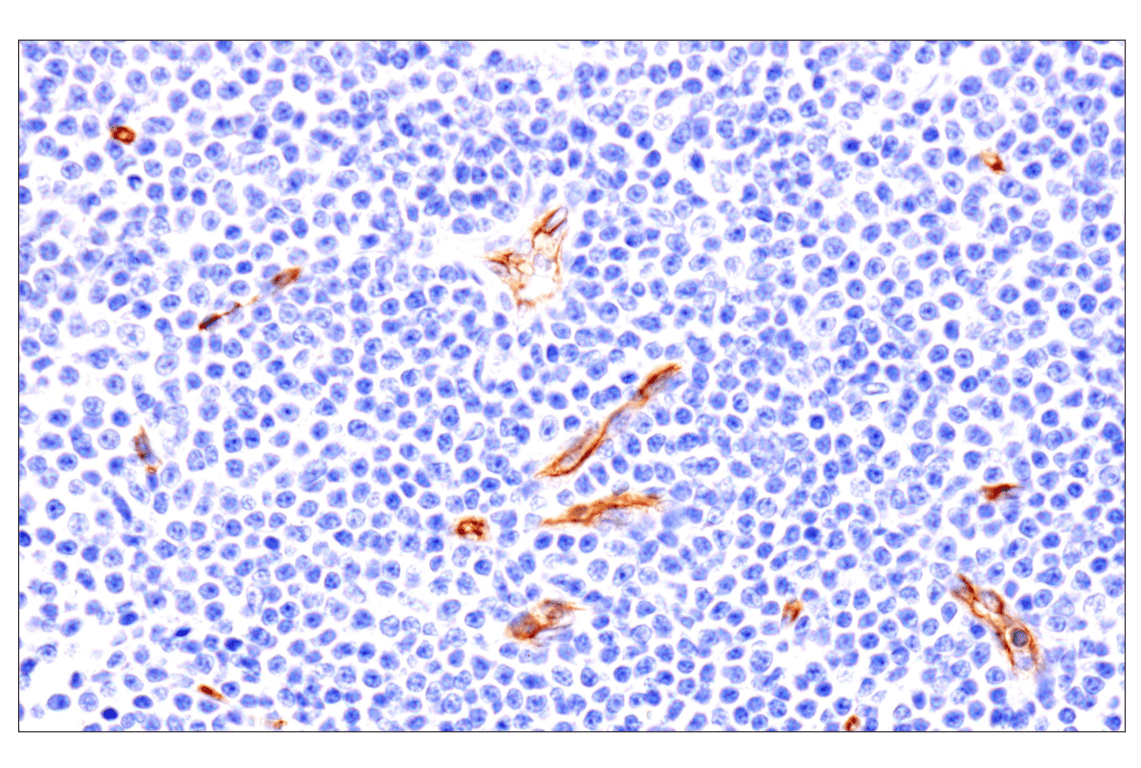 Immunohistochemistry Image 5: EMCN (E3Z4D) Rabbit Monoclonal Antibody (BSA and Azide Free)