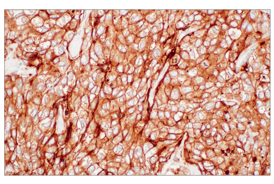 Immunohistochemistry Image 1: LY6E (F8Y1R) Rabbit Monoclonal Antibody