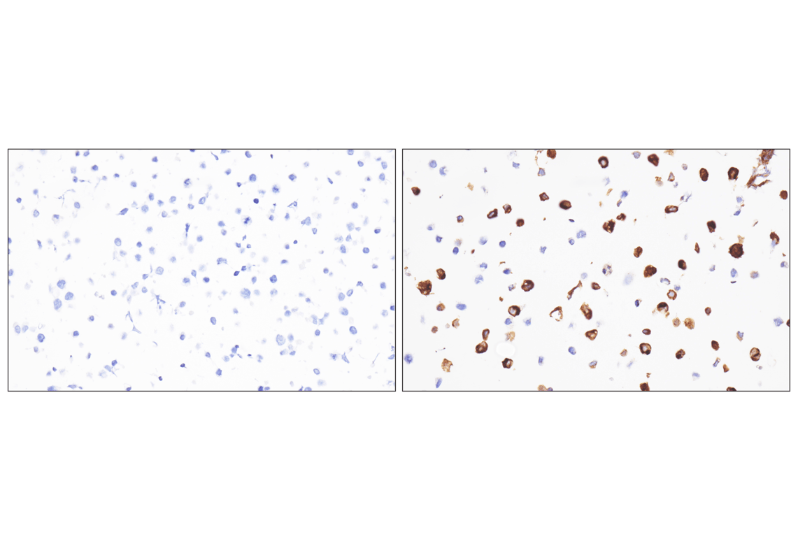 Immunohistochemistry Image 5: Thyroglobulin (F5O9B) Rabbit Monoclonal Antibody