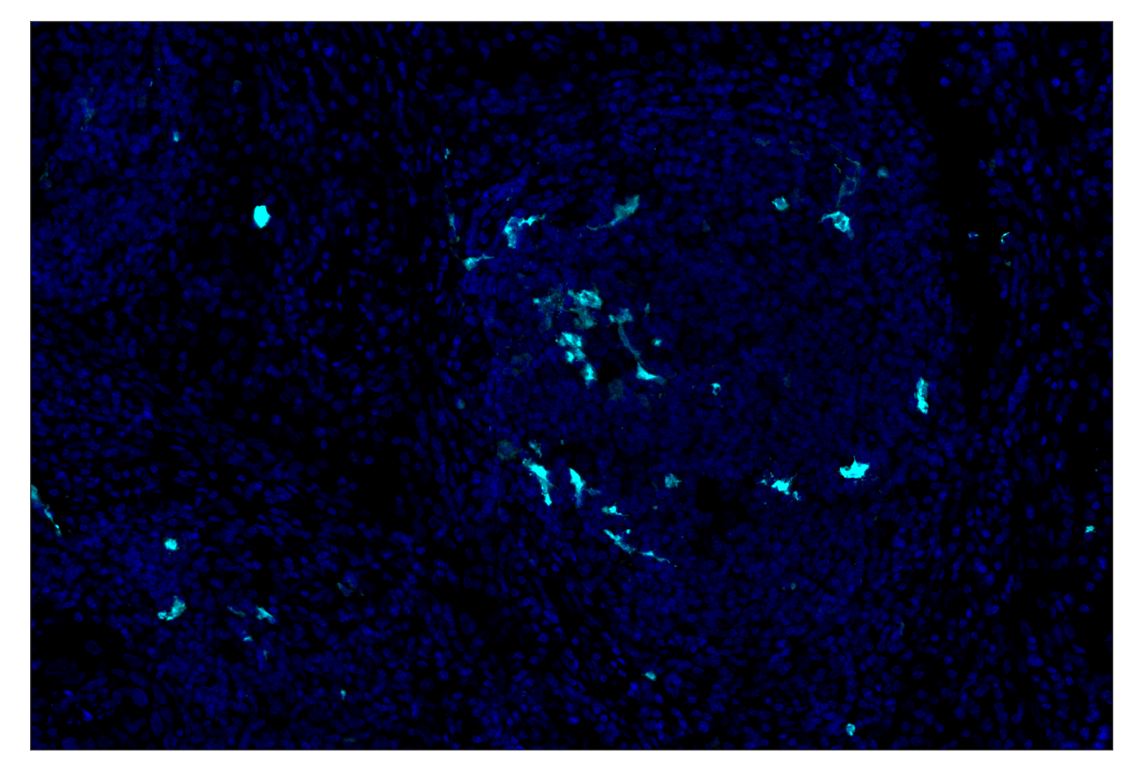 Immunohistochemistry Image 5: S100B (E7C3A) & CO-0126-594 SignalStar<sup>™</sup> Oligo-Antibody Pair