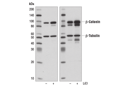 Western Blotting Image 3: Non-phospho (Active) beta-Catenin (Ser33/37/Thr41) (D13A1) Rabbit Monoclonal Antibody (BSA and Azide Free)