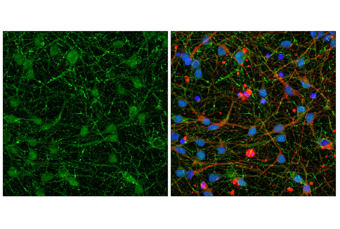 PSD95 (D27E11) XP® Rabbit mAb | Cell Signaling Technology