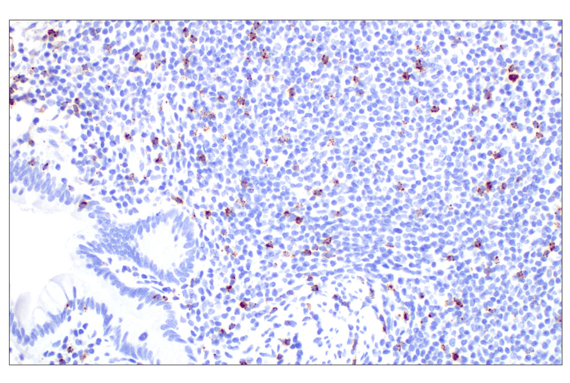 Immunohistochemistry Image 6: NKG7 (F4V5I) Rabbit Monoclonal Antibody (BSA and Azide Free)
