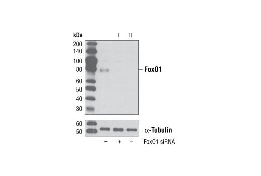 undefined Image 1: SignalSilence<sup>®</sup> FoxO1 siRNA I