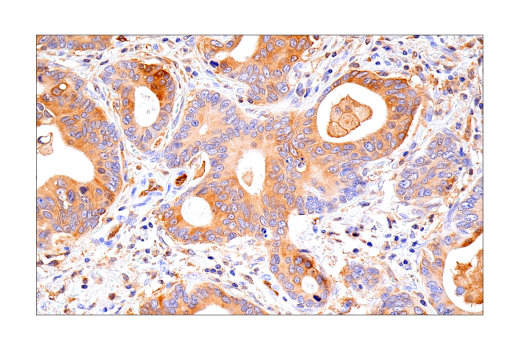 Immunohistochemistry Image 6: RIP3 (E7A7F) Rabbit Monoclonal Antibody