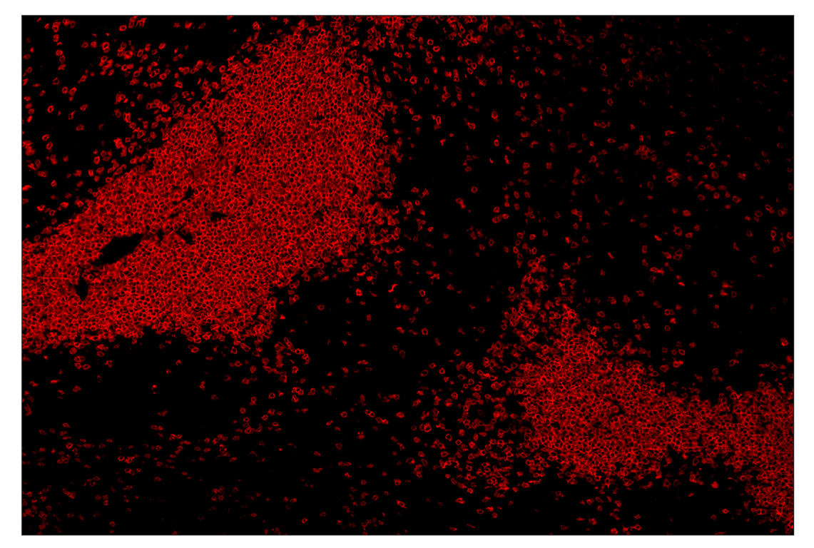 Immunohistochemistry Image 4: CD3ε (E4T1B) & CO-0048-750 SignalStar<sup>™</sup> Oligo-Antibody Pair