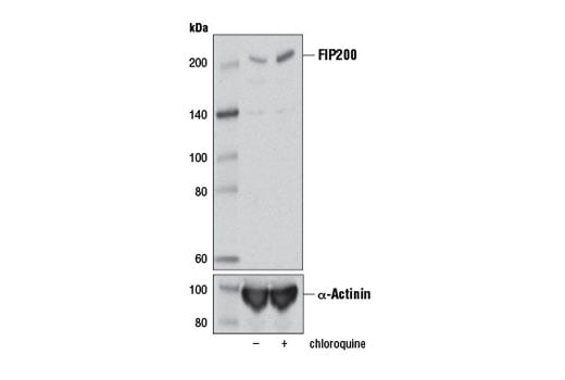 undefined Image 8: Autophagy Induction (ULK1 Complex) Antibody Sampler Kit