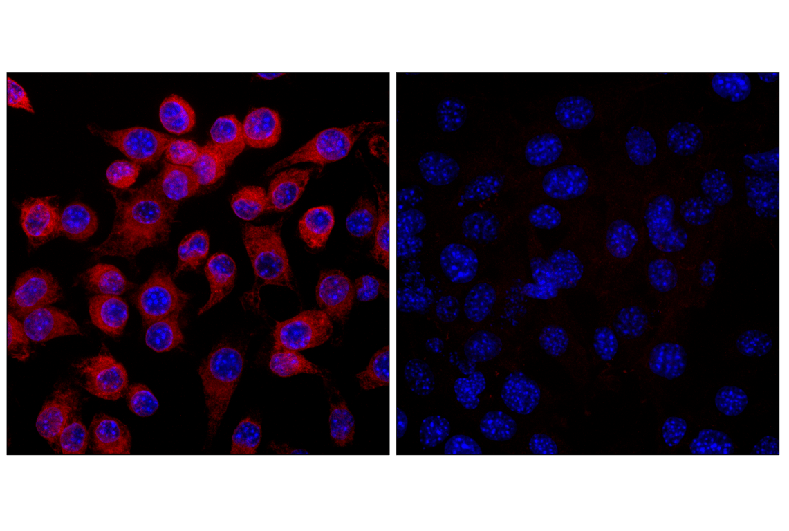 Immunofluorescence Image 1: STING (E9X7F) Rabbit Monoclonal Antibody (Alexa Fluor<sup>®</sup> 594 Conjugate)