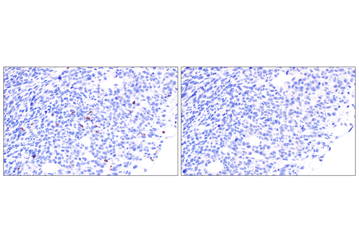 Immunohistochemistry Image 8: NCR1/NKp46 (F8M2L) Rabbit Monoclonal Antibody (IHC Formulated)