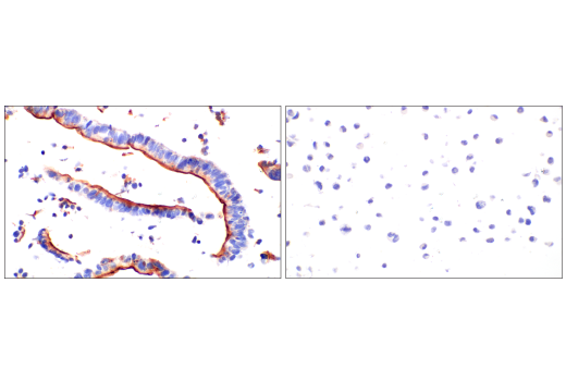Immunohistochemistry Image 5: MUC13 (E6Z1K) Rabbit Monoclonal Antibody