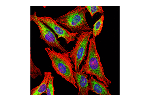 Immunofluorescence Image 1: PDI (E7O2R) Mouse Monoclonal Antibody
