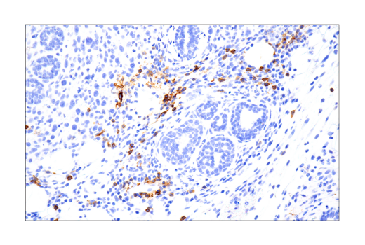 Immunohistochemistry Image 5: IL-2R alpha/CD25 (E9W2J) Rabbit Monoclonal Antibody (BSA and Azide Free)